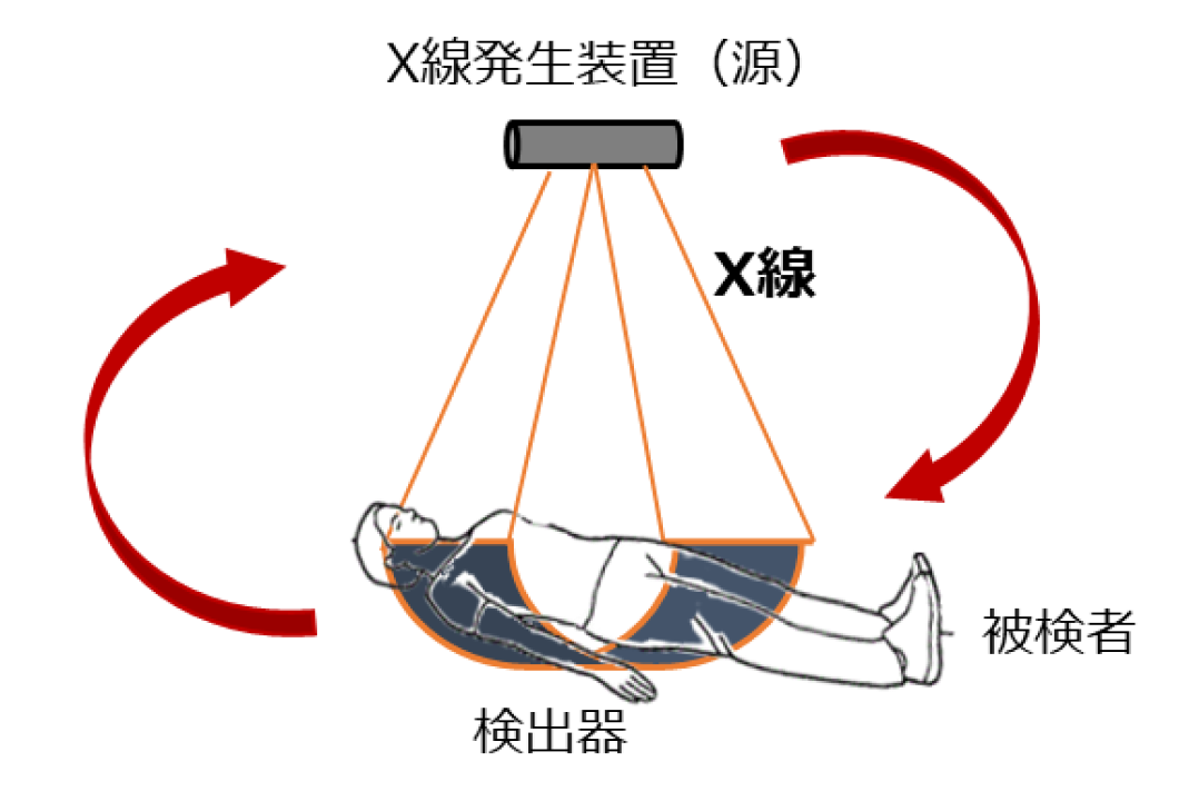 医療用X線CTスキャン装置の構造イメージ